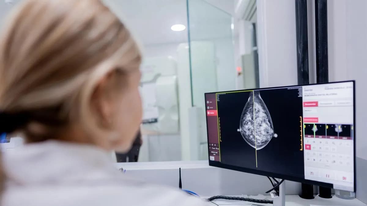 La cabergolina podría reducir el riesgo de cáncer de mama tras la lactancia