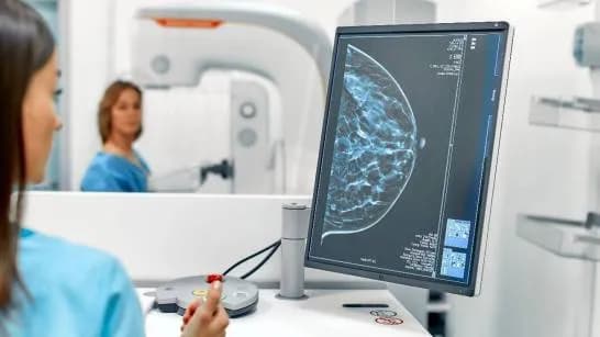 Nuevo estudio en España busca predecir riesgo de cáncer de mama