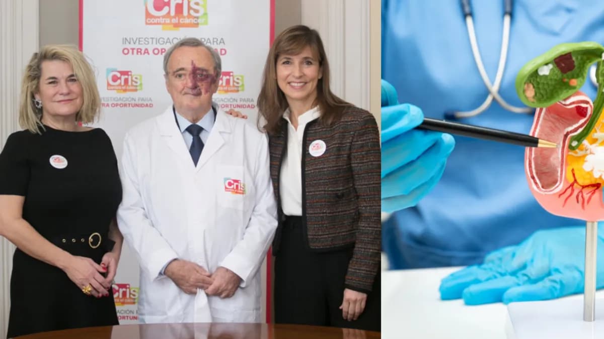 Investigadores españoles avanzan en la eliminación del cáncer de páncreas